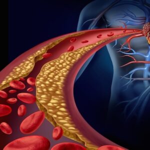 Angina: O que é e como tratar?